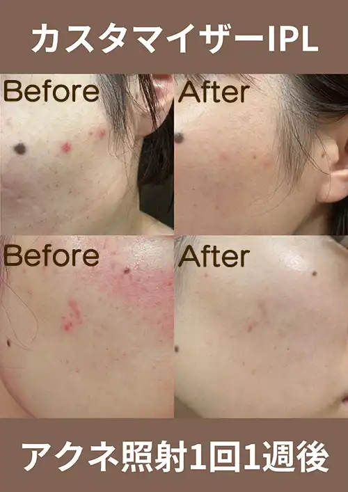 IPL機種イメージ