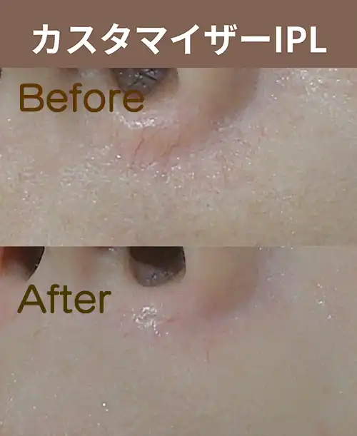 IPL機種イメージ