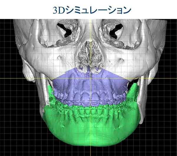 3Dシュミレーション