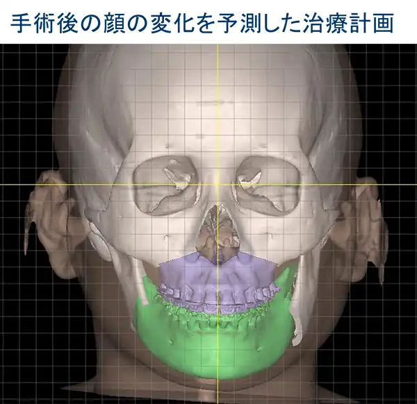 口腔外科医と矯正歯科医の情報共有